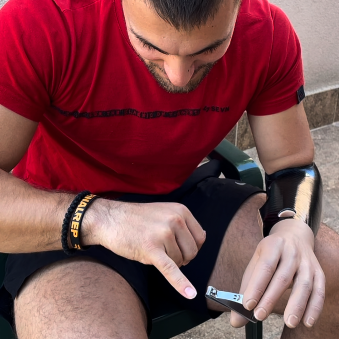 Mioelektrična proteza za ruku, moderna tehnologija koja omogućava prirodno upravljanje pokretima. Ova proteza pruža funkcionalnost i udobnost korisnicima, poboljšavajući kvalitet života.