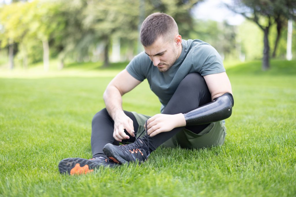 Proteza za ruku – mioelektrična, estetska i mehanička proteza koja omogućava funkcionalnost i samostalnost korisnika