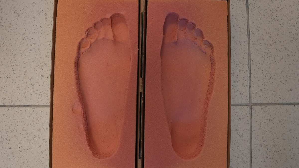 ortopedski ulošci po meri Novi Sad – individualni ortopedski ulošci izrada