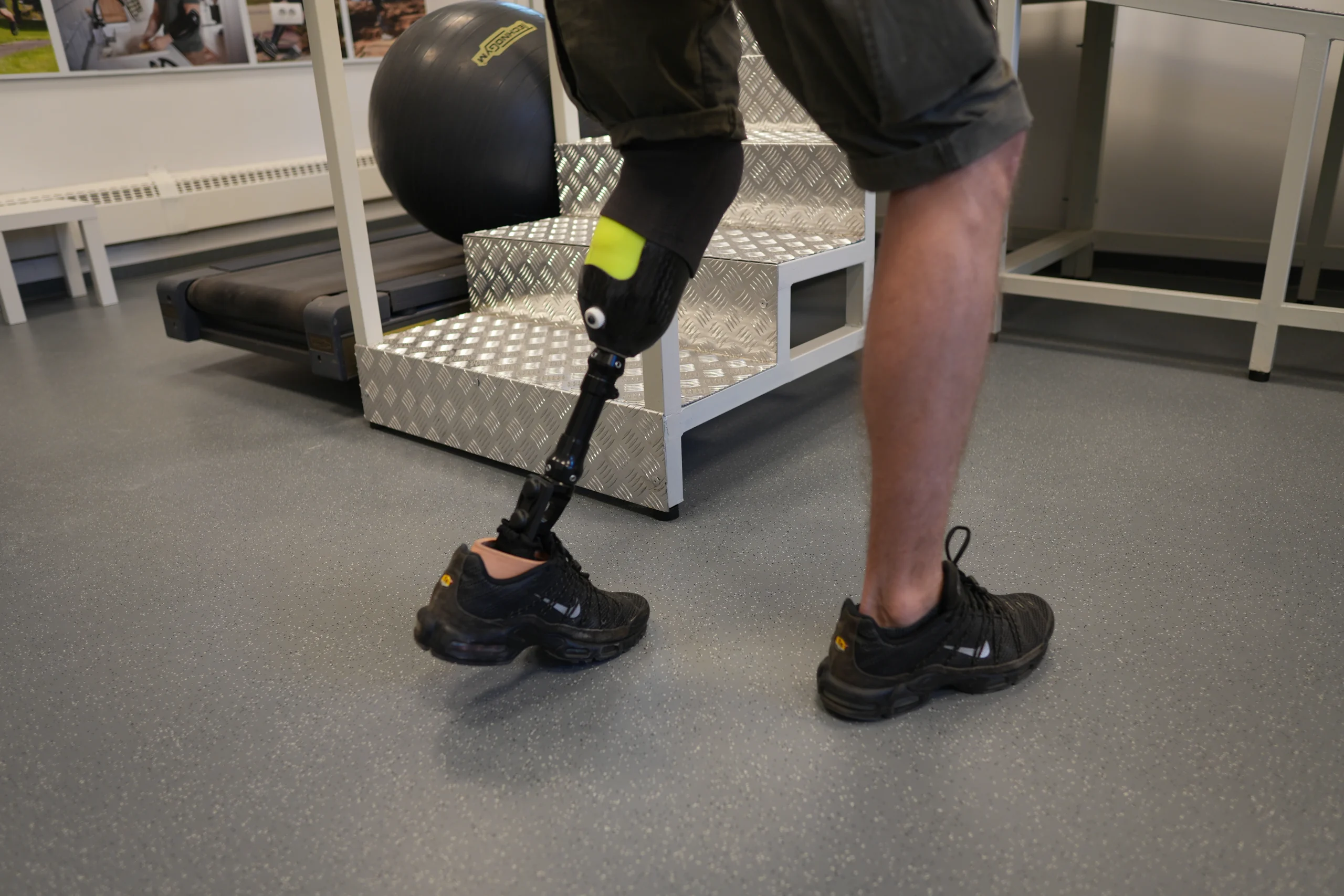 Potkolena proteza za nogu omogućava stabilno i prirodno hodanje uz maksimalnu udobnost