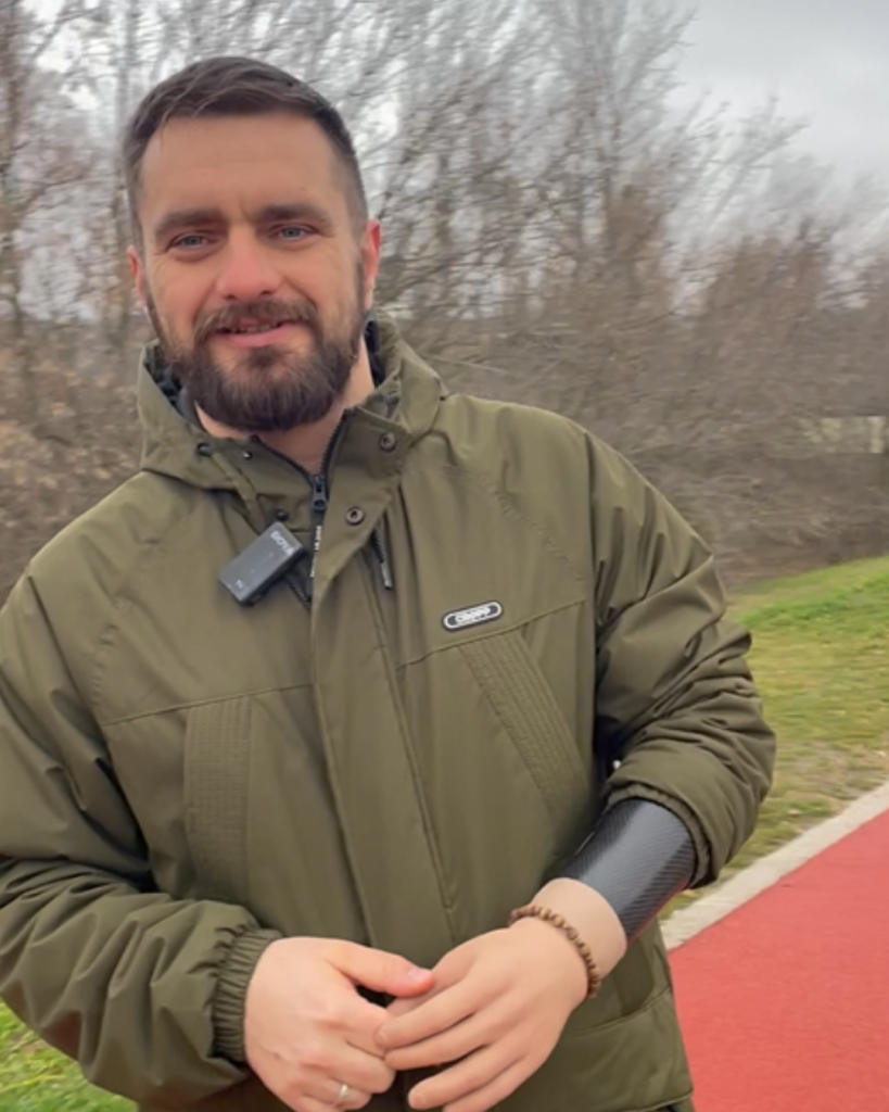Korisnik nosi mioelektričnu protezu za ruku sa karbonskim ležištem.