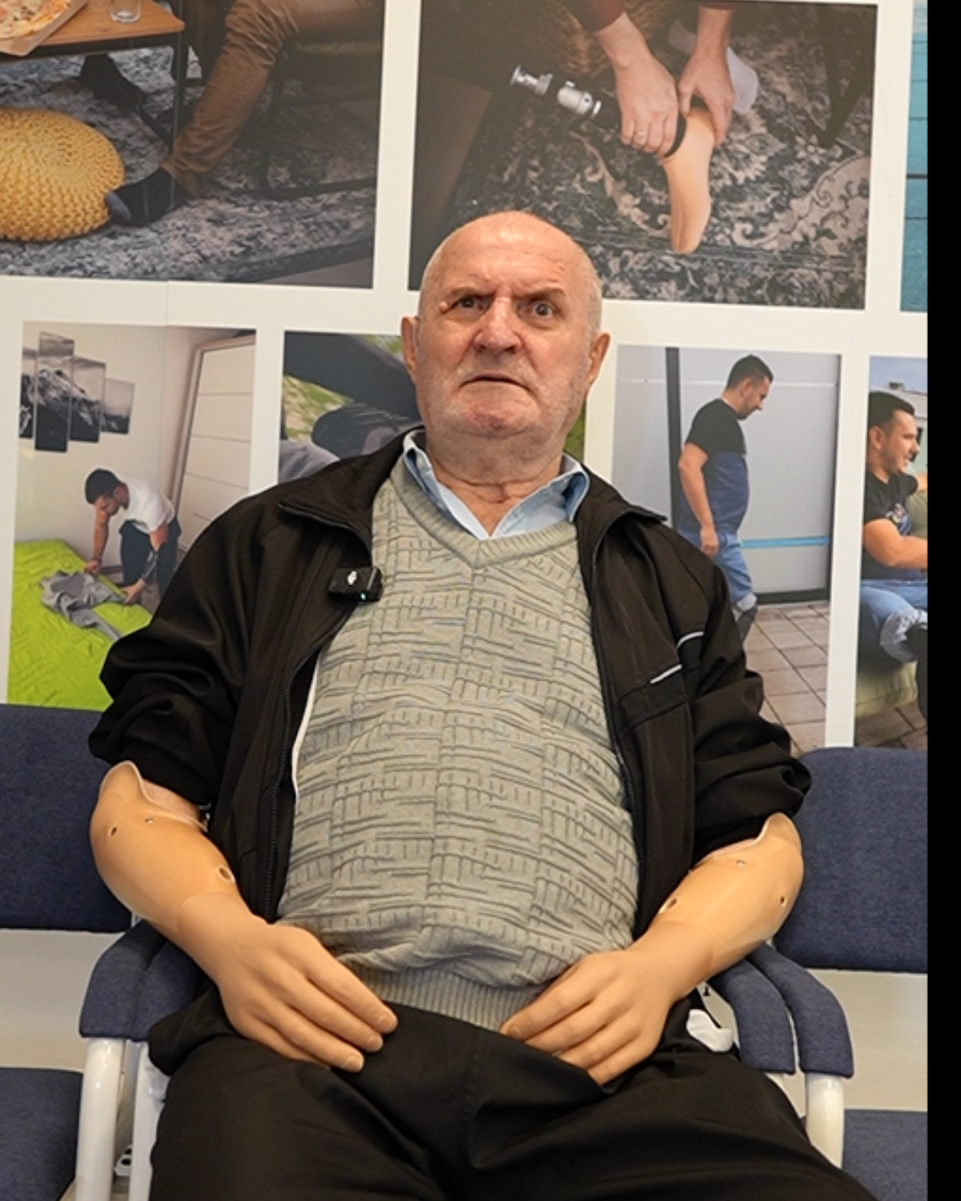 Stariji pacijent sedi u ortopedskoj ordinaciji sa dve mioelektrične proteze za ruke.
